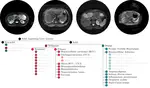 Diagnosis of solid appearing lesions based on MRI and deep learning