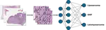 AI-Based Phenotyping of Soft Tissue Tumors from Histopathology Images
