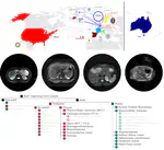 NWO OTP Grant for Liver Artificial Intelligence (LAI) consortium