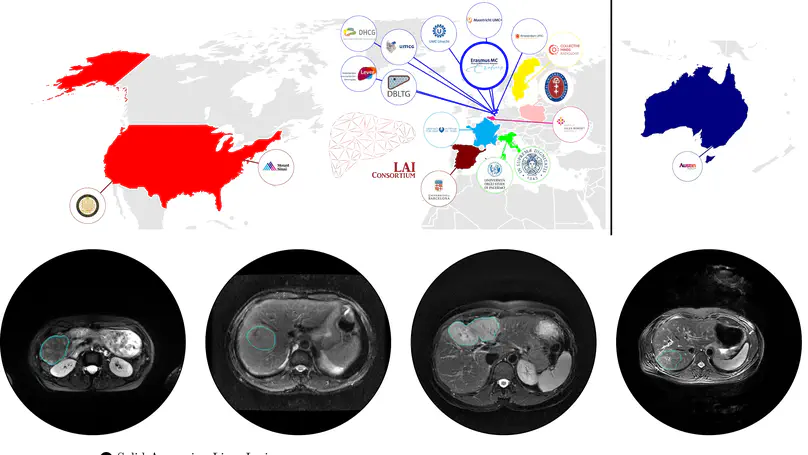 NWO OTP Grant for Liver Artificial Intelligence (LAI) consortium